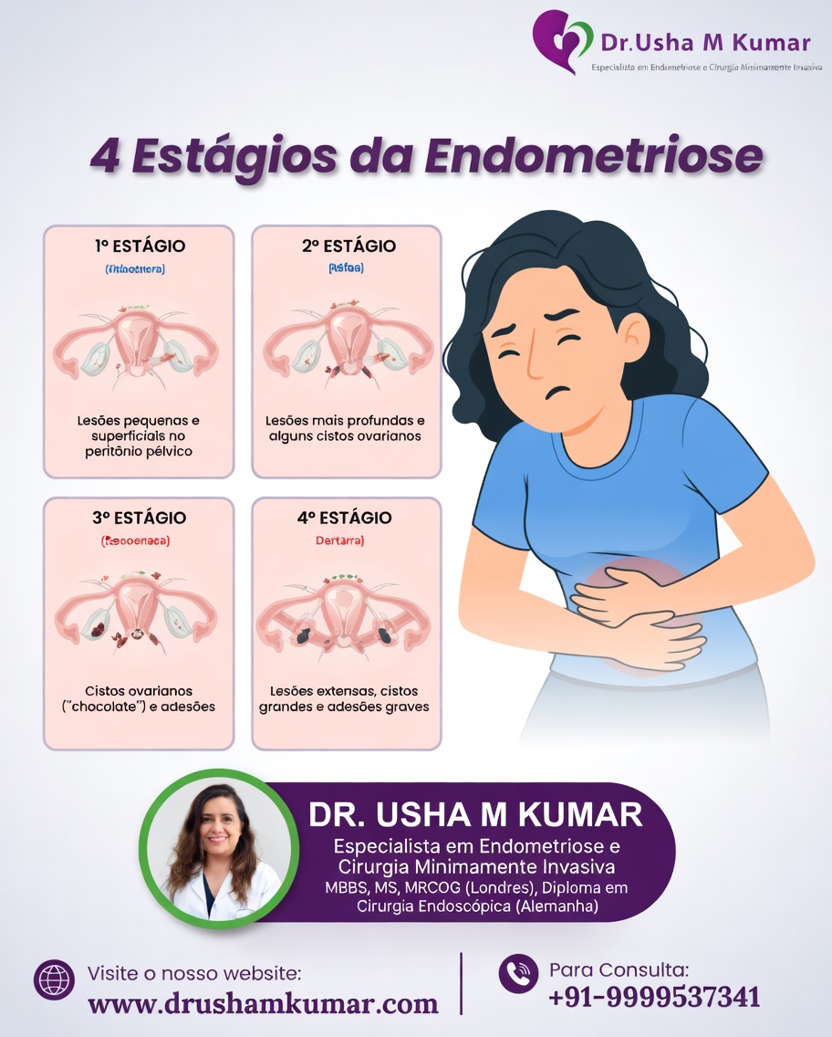 O que toda mulher deve saber sobre endometriose