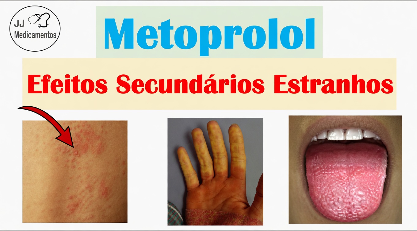 Quais são os 10 efeitos colaterais comuns do metoprolol e como você pode identificá-los precocemente?