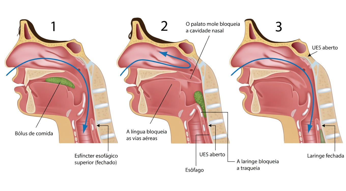 Por que o muco e o catarro se acumulam tão facilmente