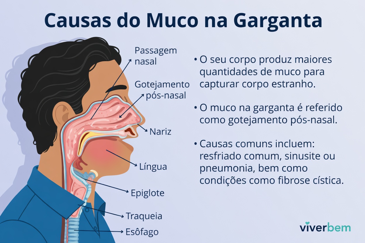 Por Que Você Tem Catarro Persistente na Garganta e Fatores do Dia a Dia Que Você Deve Conhecer