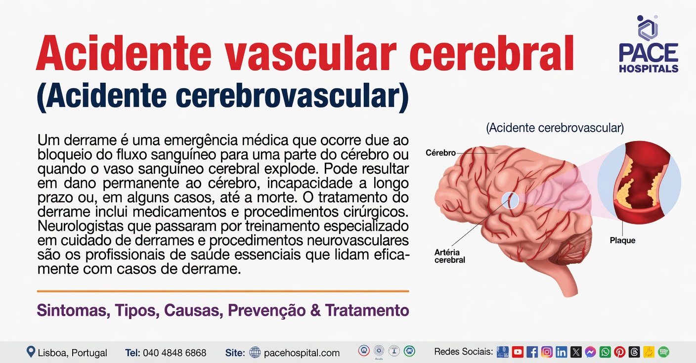 Este sintoma do sono pode ser um sinal de alerta de um AVC?