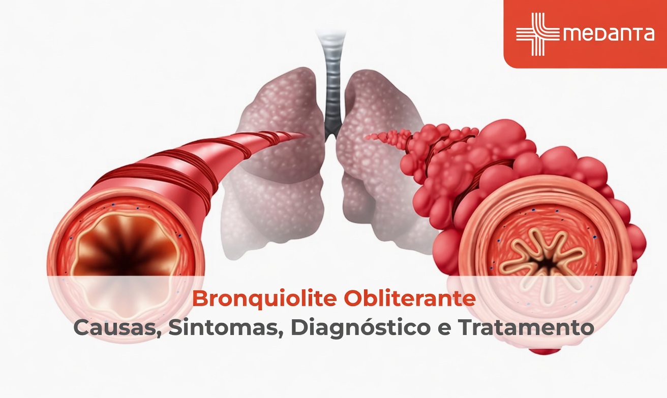 Vaping e pulmão de pipoca: um risco silencioso que muitos adultos ainda ignoram