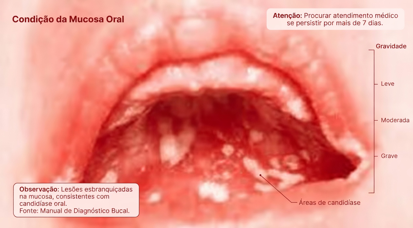Descubra o que aquelas bolinhas brancas na sua boca podem significar e hábitos diários que valem a pena experimentar