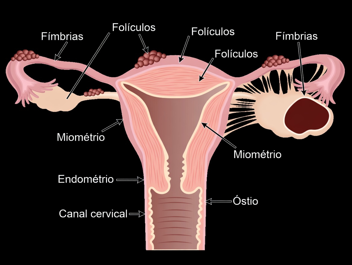 Alerta para endometriose: hábitos do dia a dia que você não deve ignorar