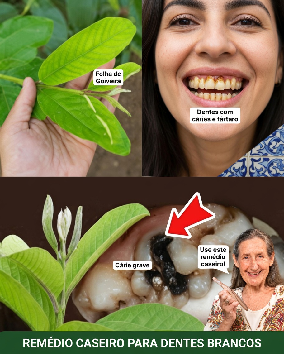 As 3 Melhores Formas de Tratar a Cárie Dentária com Folhas de Goiaba – Simples e Econômicas
