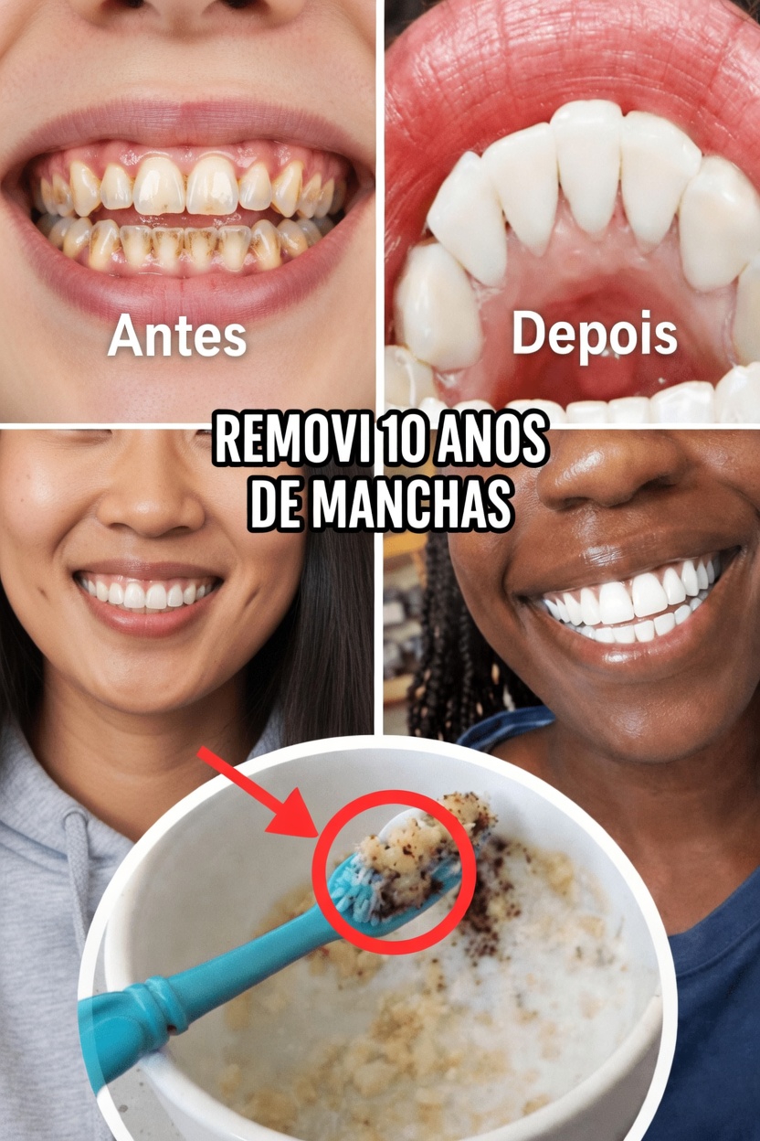 Por que manchas superficiais acontecem e por que o polimento suave é importante