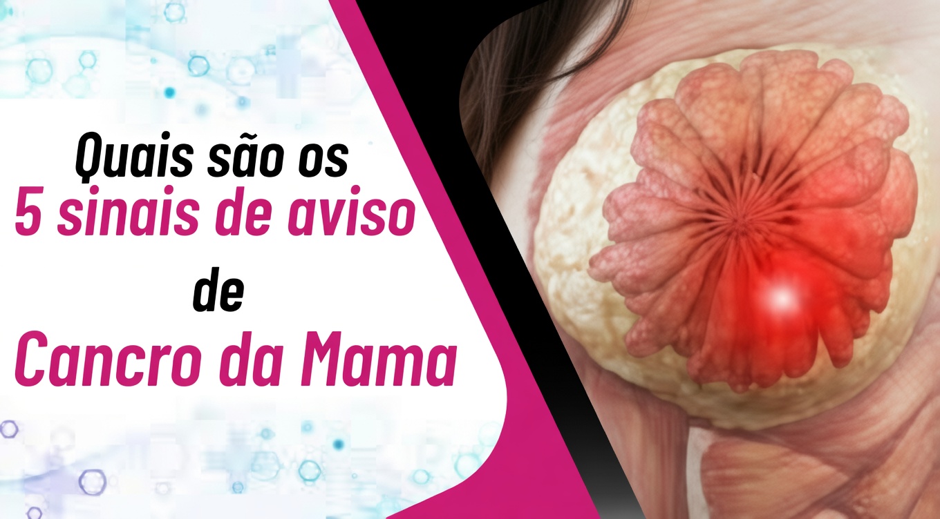 4 sinais de alerta precoce do câncer de mama que toda mulher deve conhecer