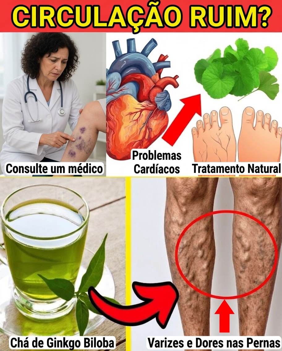 10 maneiras naturais de aliviar o desconforto das varizes e melhorar a circulação sanguínea