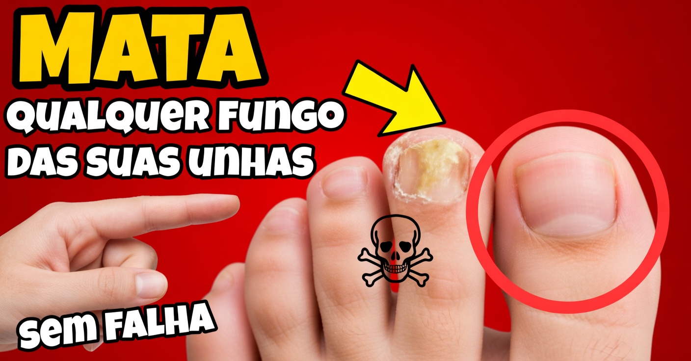 Vinagre para fungos nas unhas