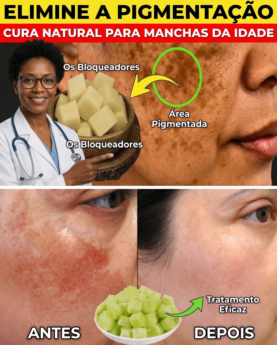 Elimine a Pigmentação, o Melasma e as Manchas Escuras Naturalmente em 20 Dias – Um Ritual Suave para uma Pele Radiante