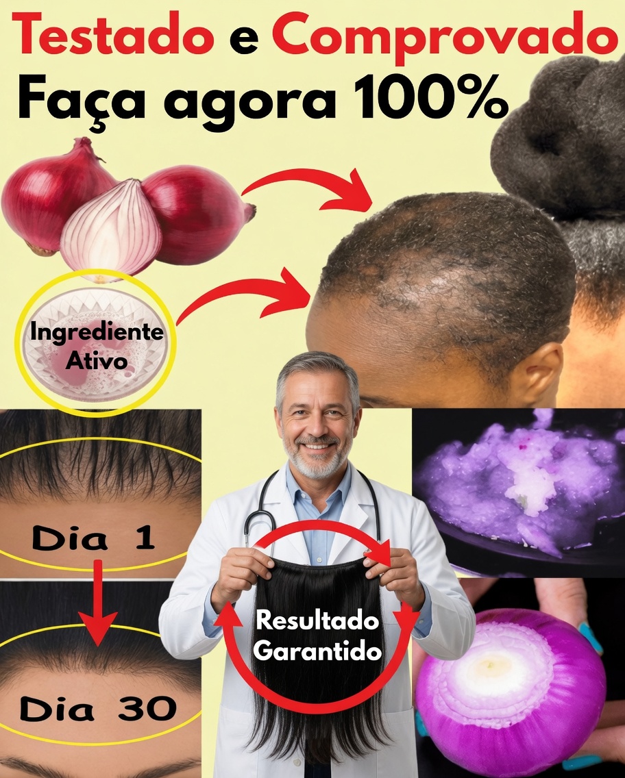 Óleo de Cebola para o Crescimento do Cabelo: Um Remédio Natural Simples que Realmente Funciona