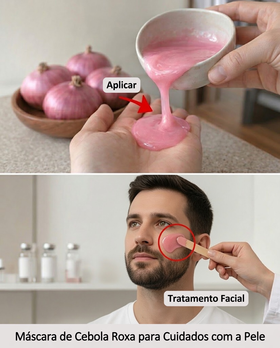 Cebola Roxa para o Rosto: O Truque Natural que Milhares Estão Usando para Suavizar Rugas, Manchas Escuras e Pigmentação