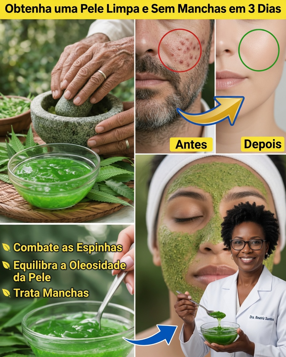 Como Fazer e Usar um Gel Caseiro de Neem para uma Pele Mais Saudável em Casa
