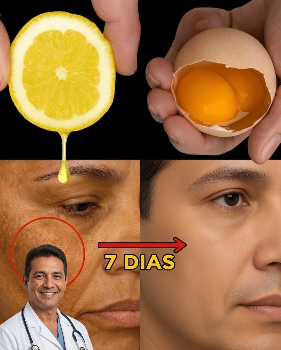 Mistura de Limão e Ovo para uma Pele Naturalmente Jovem