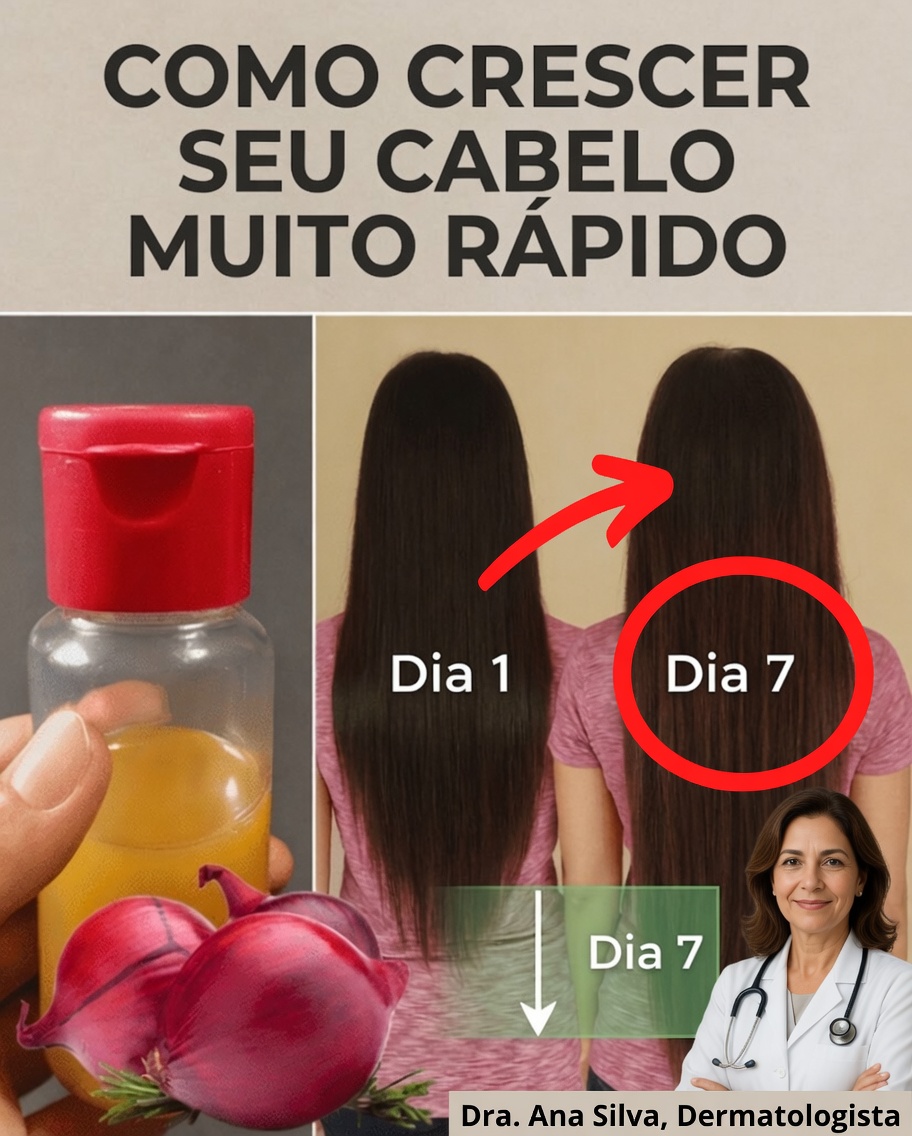 Como Fazer Óleo de Cebola para o Crescimento Rápido do Cabelo e Parar a Queda