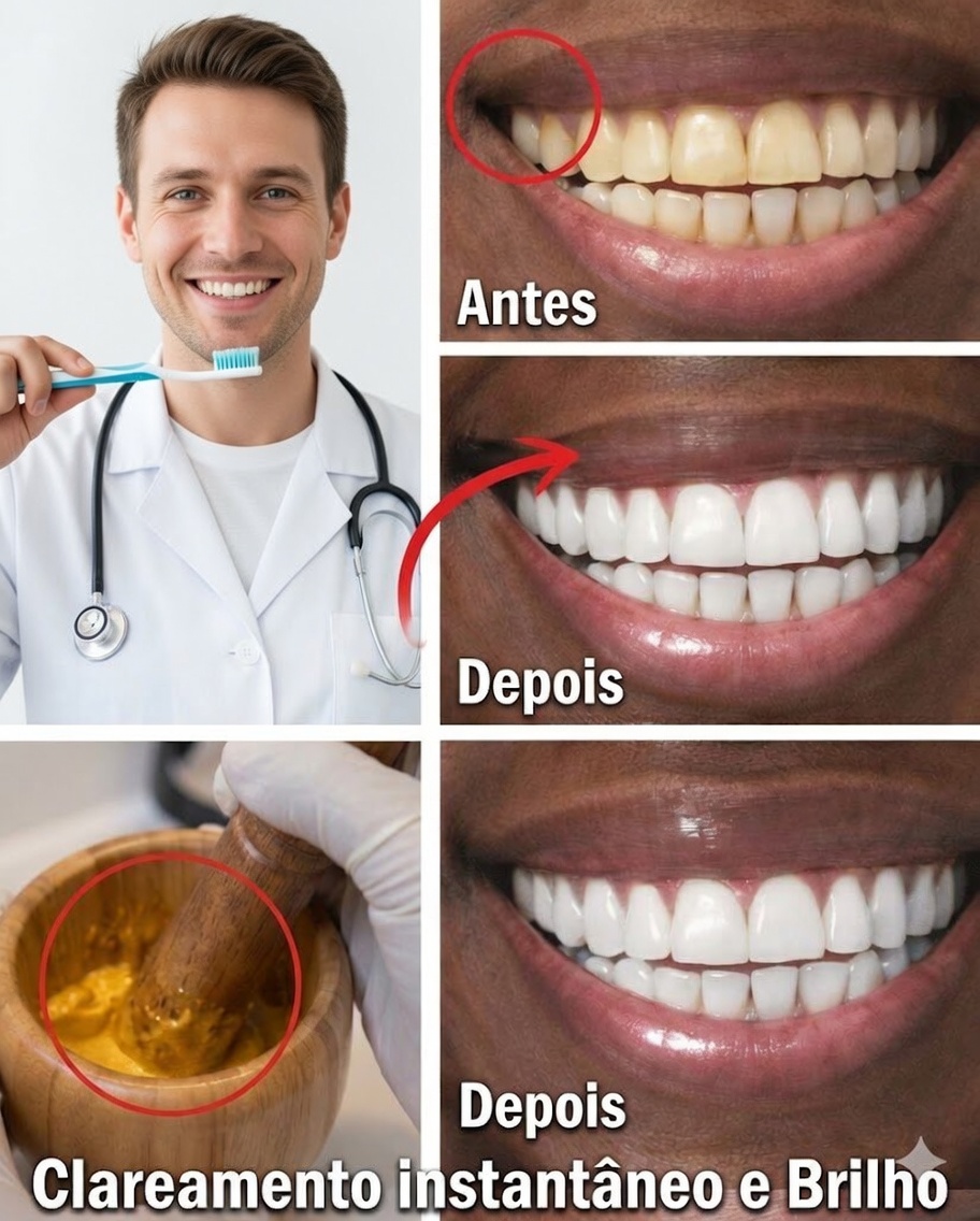 Como Clarear Dentes Amarelados Naturalmente em Casa: O Segredo Poderoso de Banana, Gengibre e Limão que Está Chamando Atenção