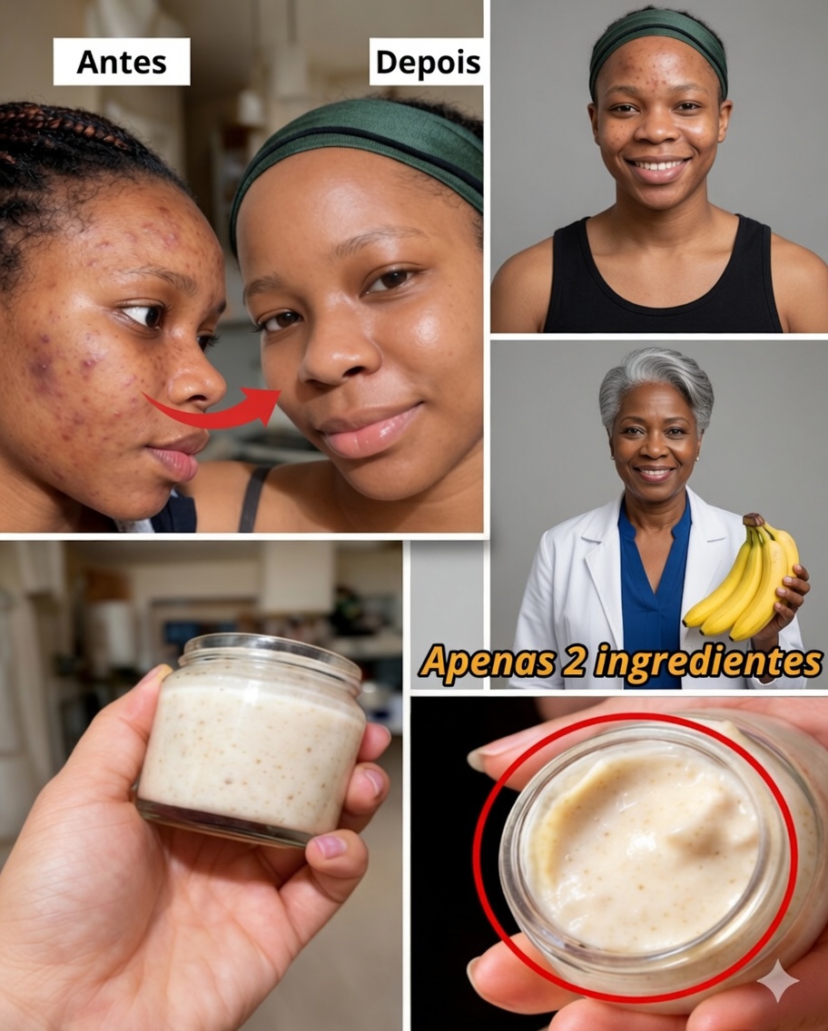 7 Formas Naturais de Suavizar Linhas Finas e Iluminar a Pele Usando Casca de Banana