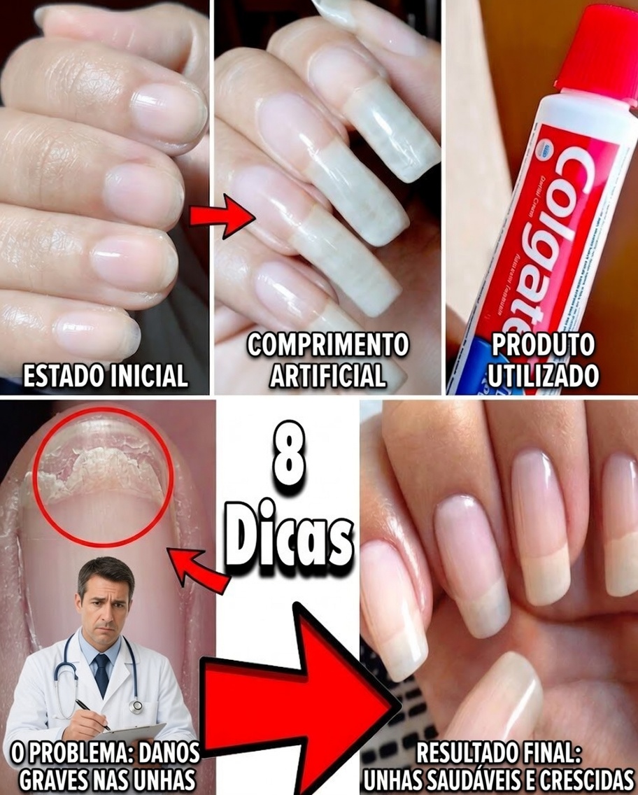 Revitalize Unhas Fracas Naturalmente: O Poderoso Segredo do Alho para Unhas Mais Fortes e Saudáveis
