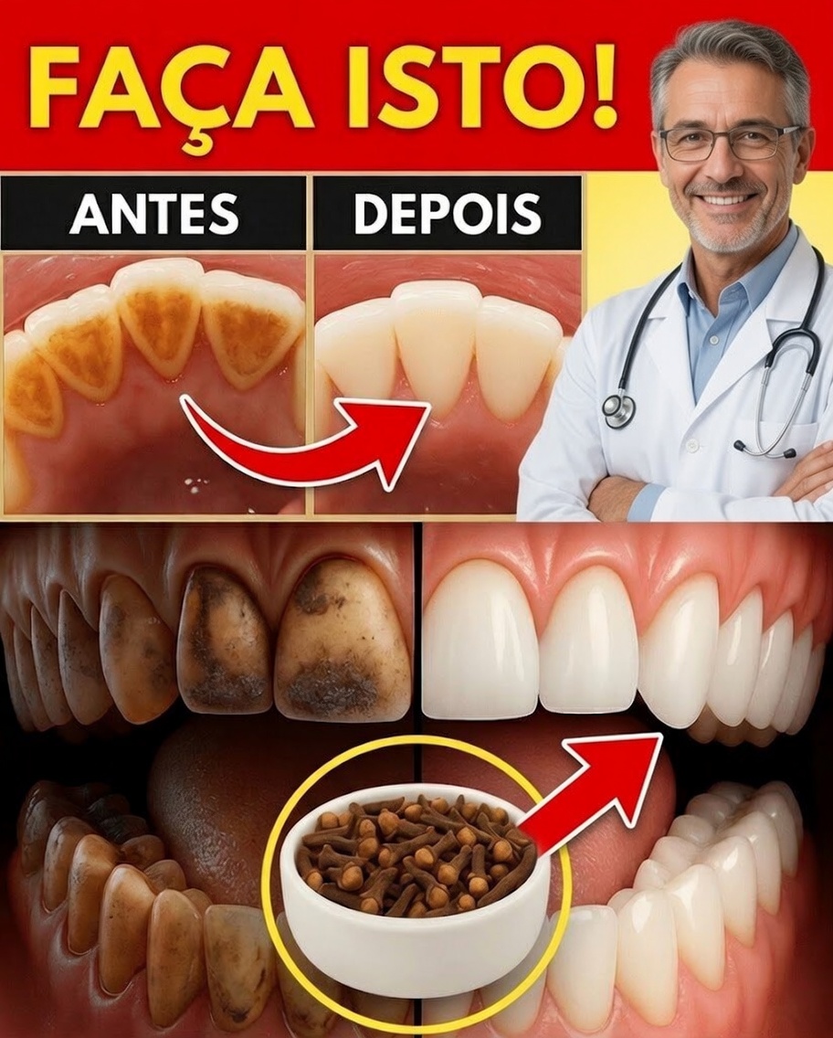 9 Remédios Caseiros Comprovados para Remover Placa e Tártaro Naturalmente