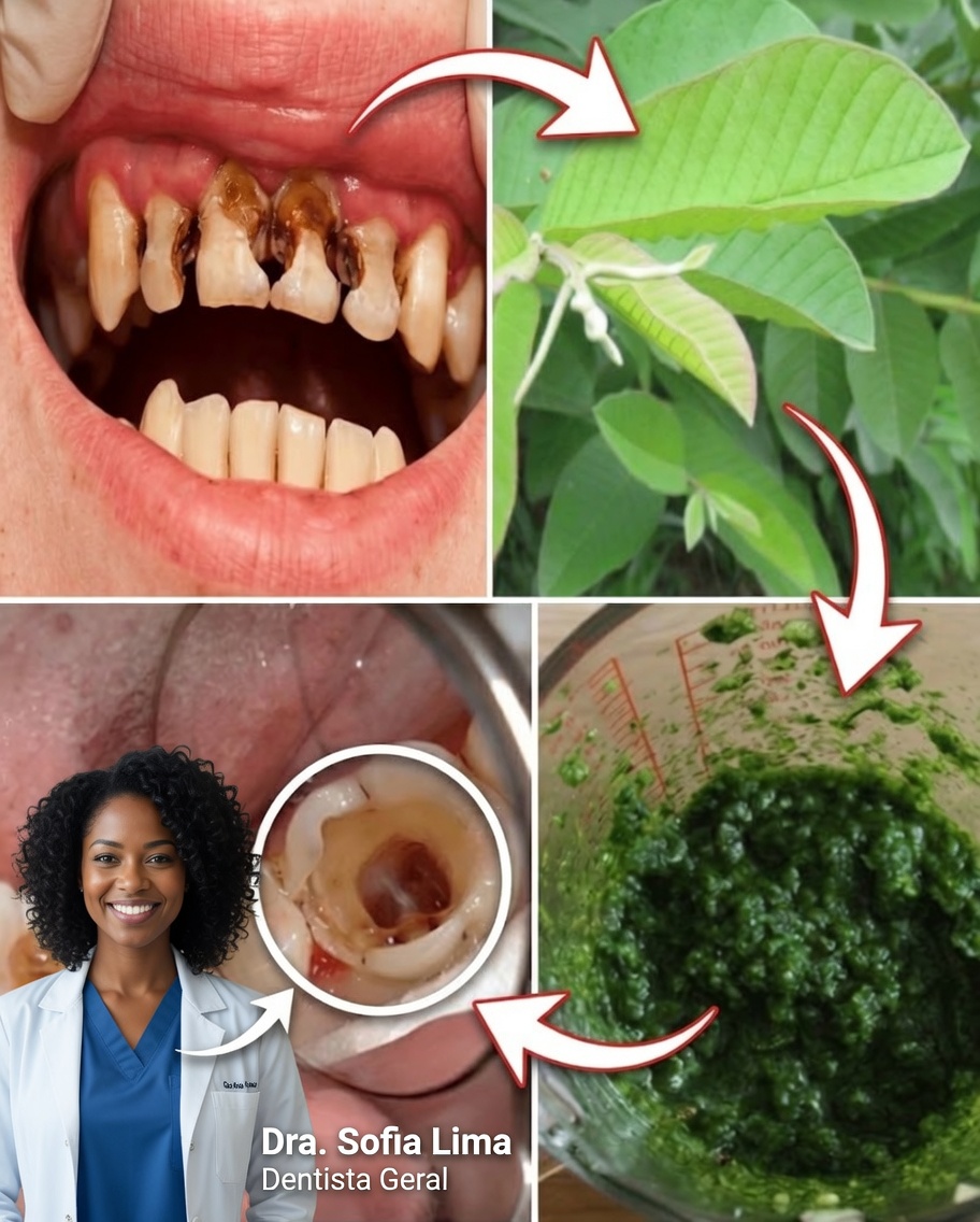 Folhas de goiabeira para um sorriso radiante: o segredo natural de cuidados bucais passado por uma avó de 70 anos