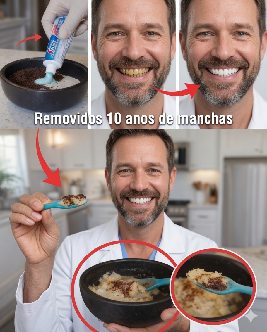 Remova até 10 anos de manchas dos dentes em apenas 2 minutos – o clareador natural que está chamando atenção